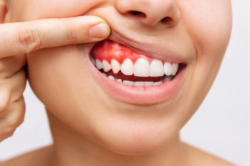 Dental Treatments in Surfside Beach